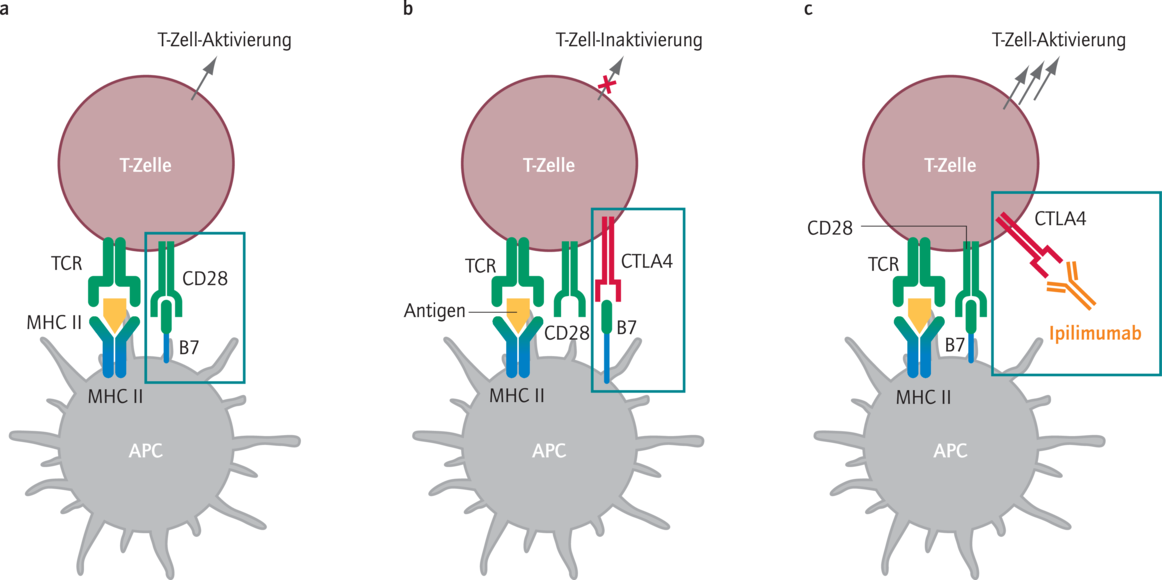 Immuntherapie Mit Ipilimumab In Der Zweitlinientherapie - 01 - 2012 ...