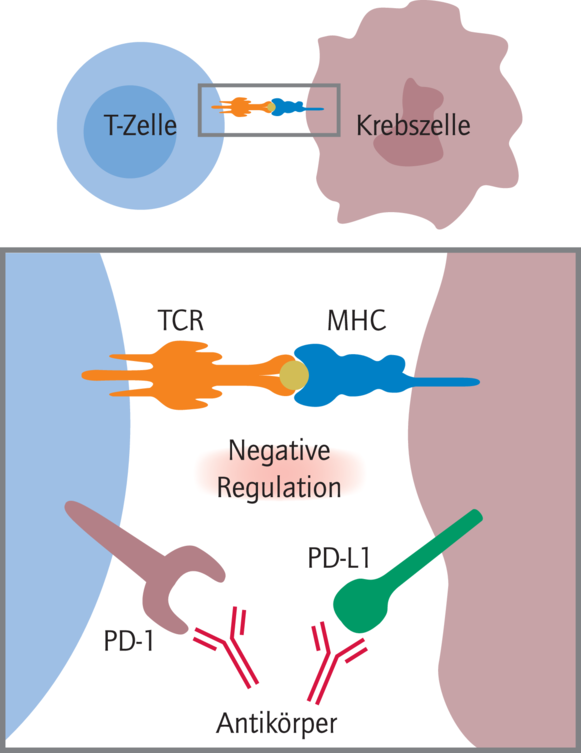 Pembrolizumab Verspricht Beträchtlichen Zusatznutzen - 05 - 2016 ...